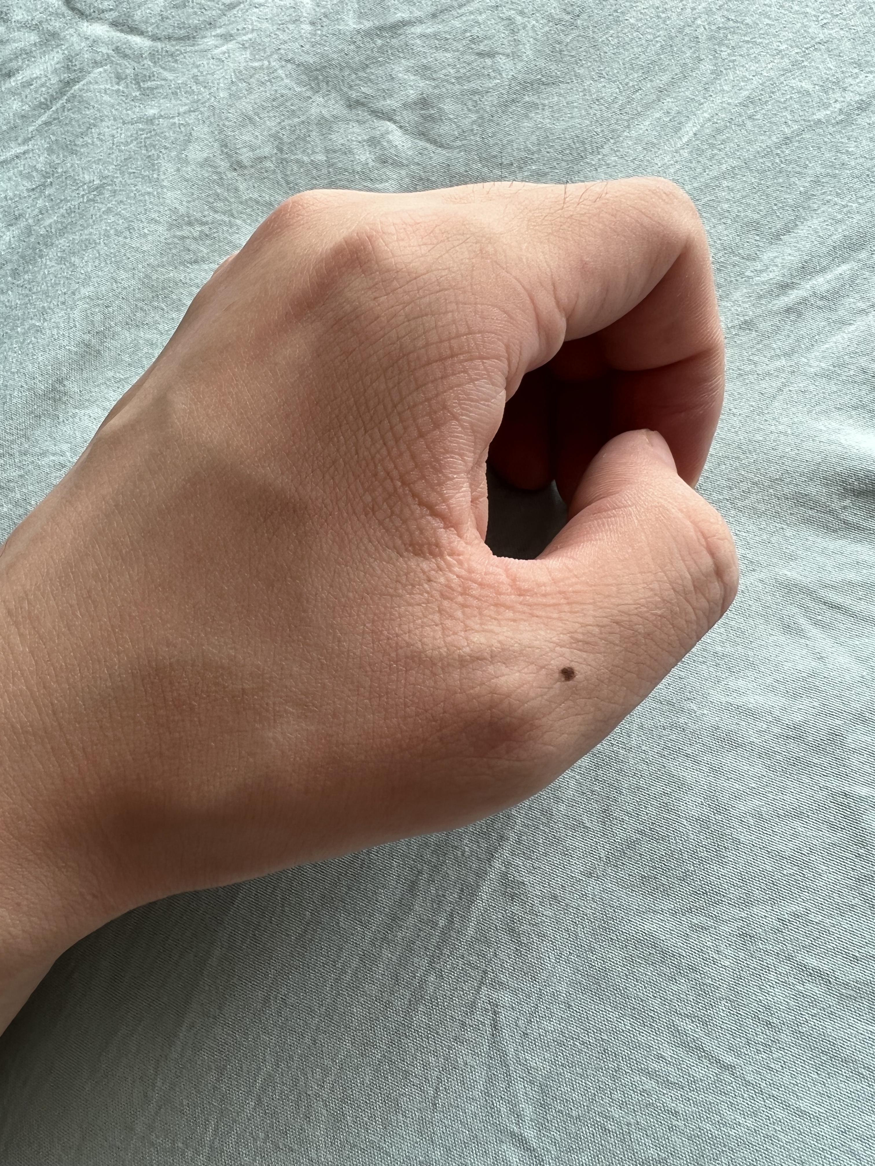 ‘后巷牙’狼人皮肤登场！