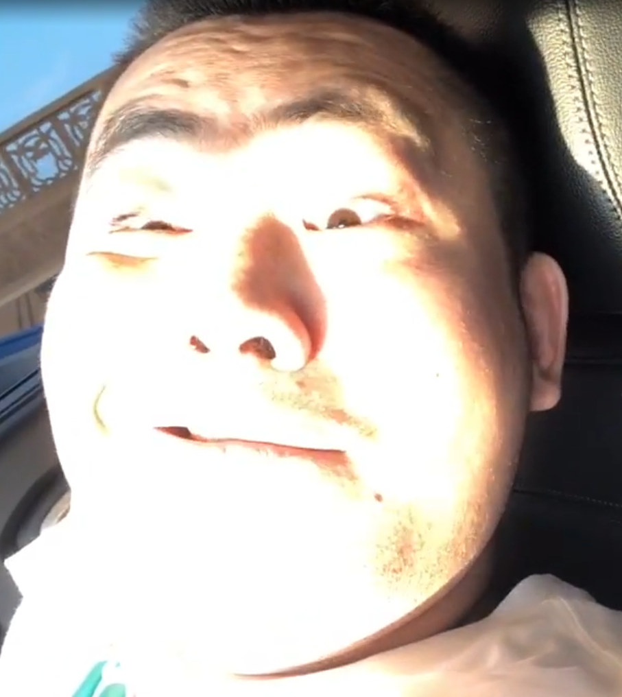 关爱帕金森患者，让世界充满爱！